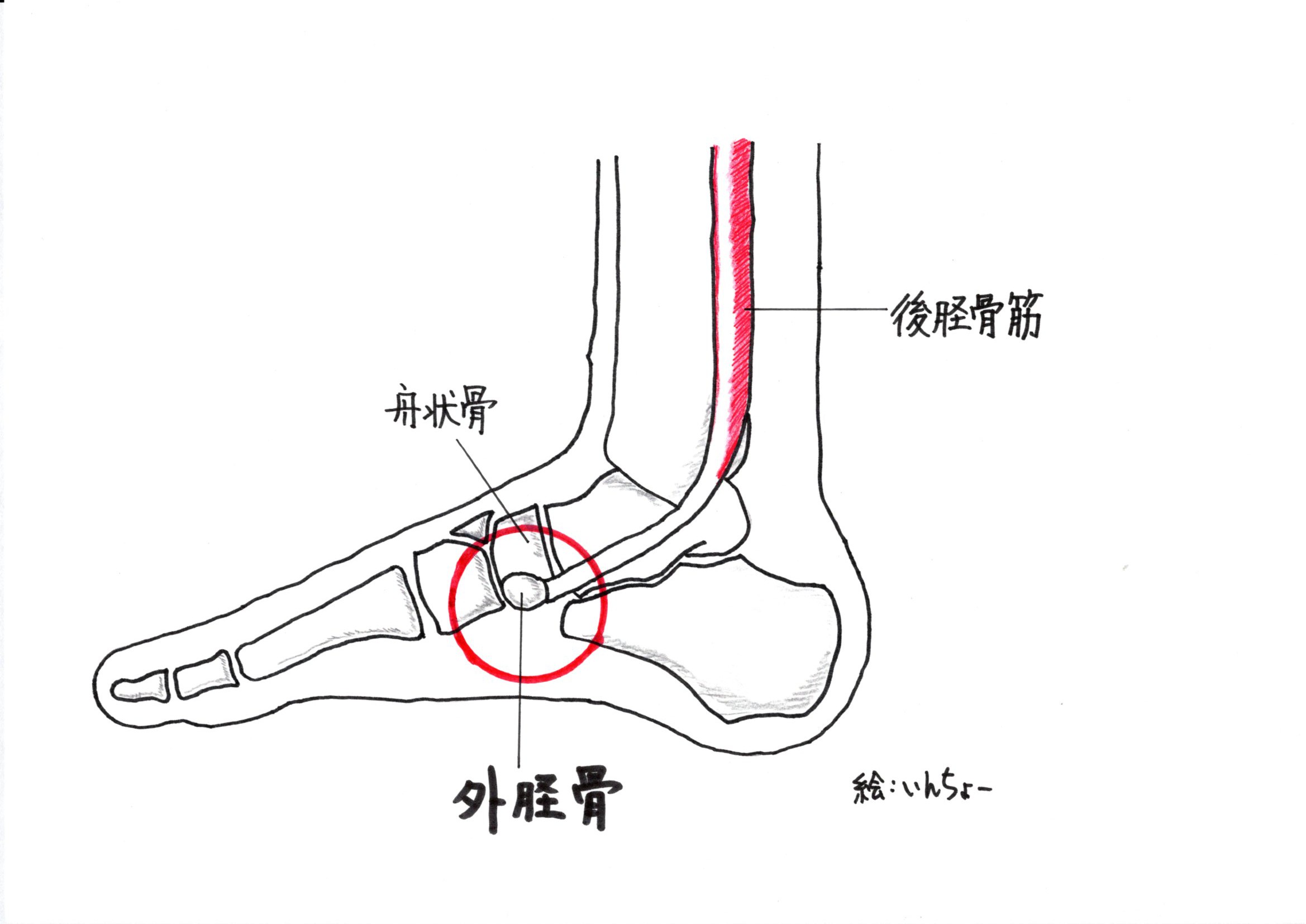 の 痛い が 足 内側 膝内側の痛み